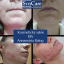 ŠKOLENIE BIOrevitalizujúci AHA PEELING 05.10.2026